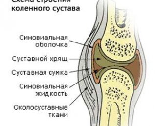 Синовит коленного сустава – 8 видов и эффективное лечение
